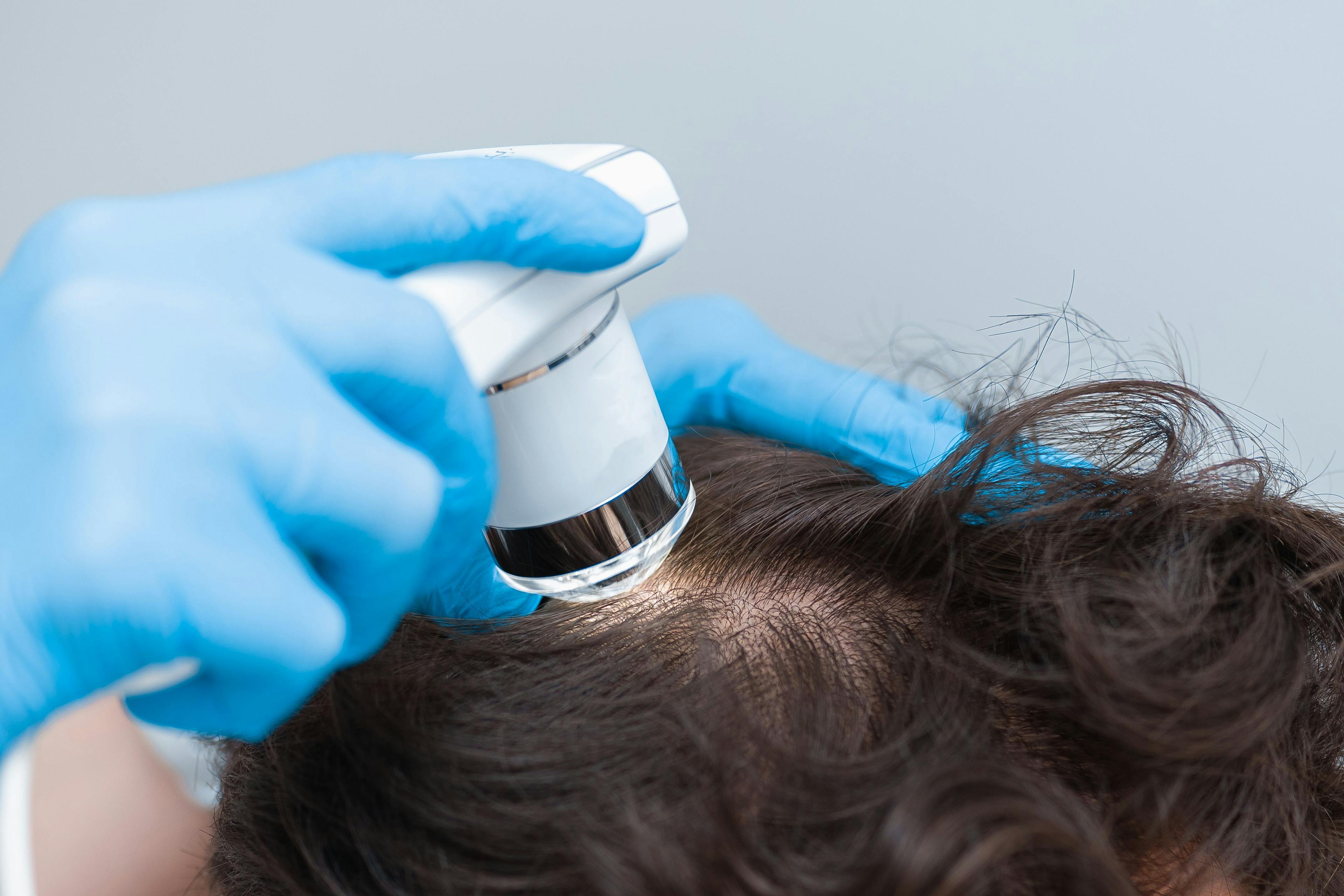 Doctor examining patient scalp | Image Credit: © salomonus_ - stock.adobe.com