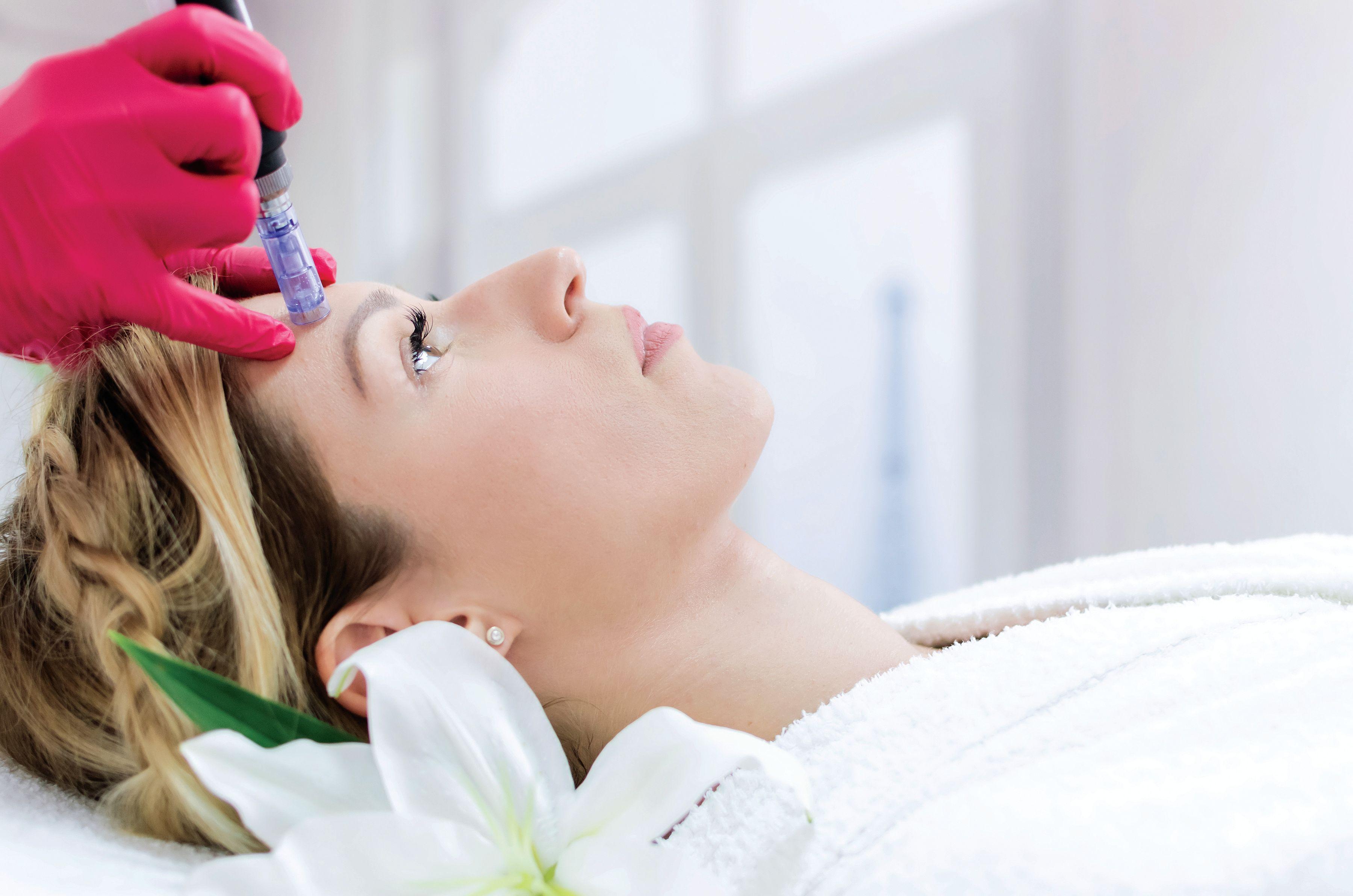 woman receiving microneedling treatment