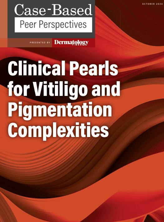 October 2024 Vitiligo Complexities Supplement Recap