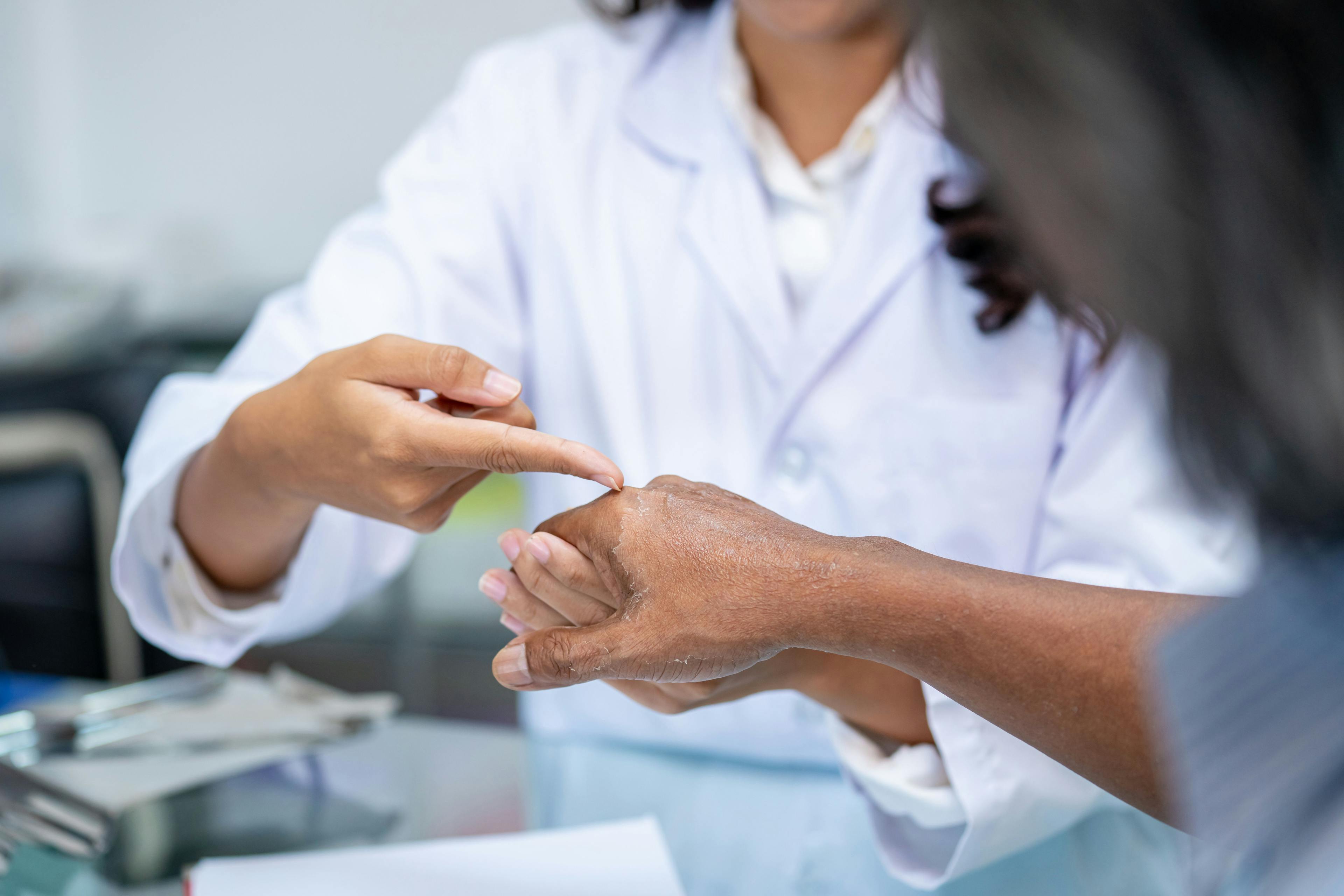 Doctor assesses patient with psoriasis | Image Credit: © CandyRetriever - stock.adobe.com