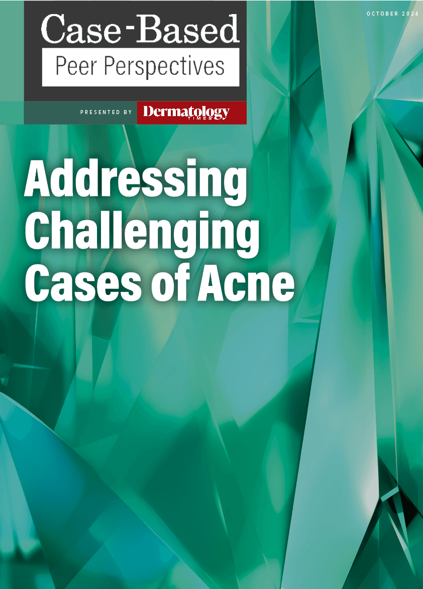 Addressing Challenging Cases of Acne: Part 3