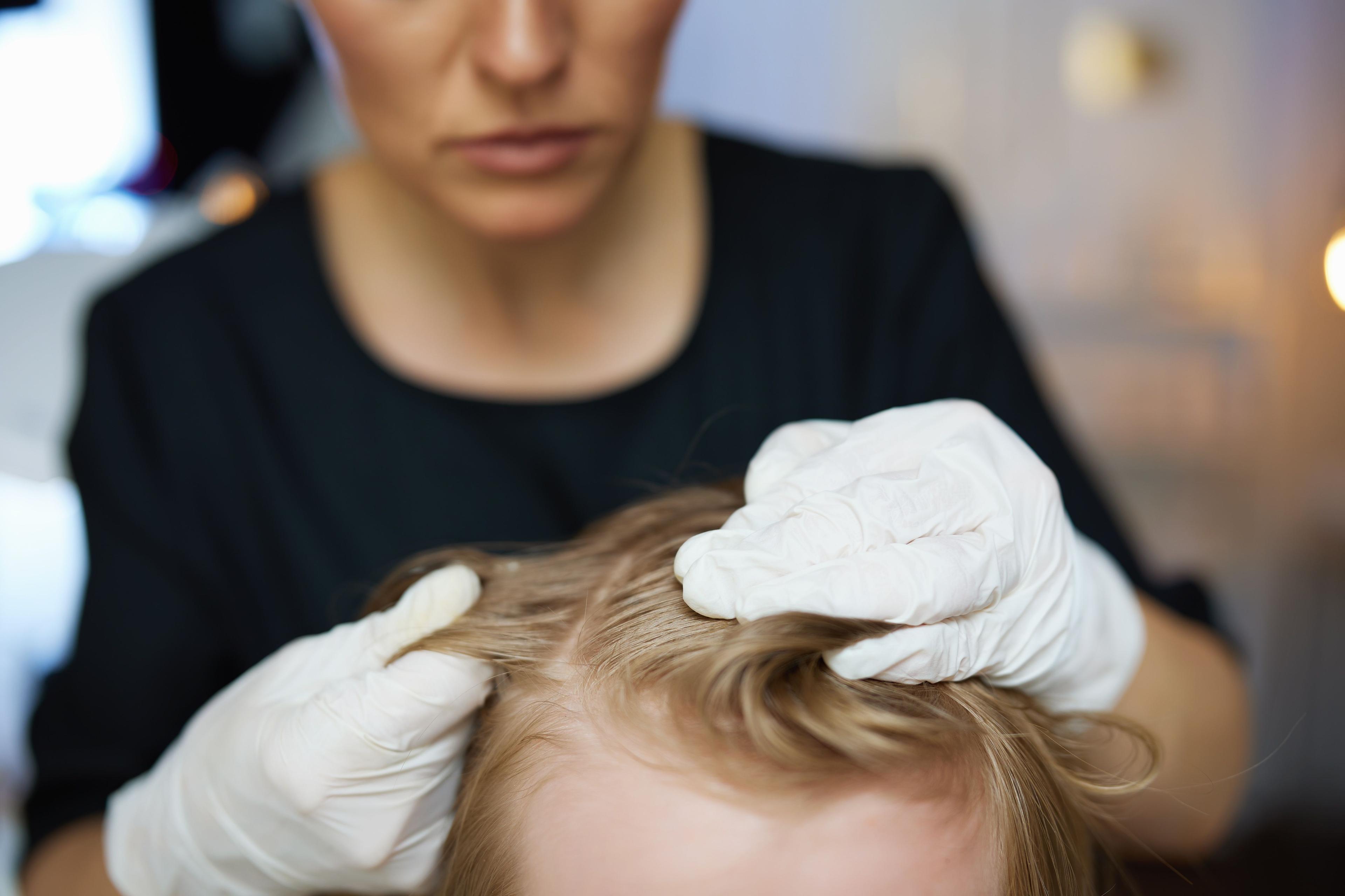 Dermatologist looking at patient hair | Image Credit: © Alliance - stock.adobe.com