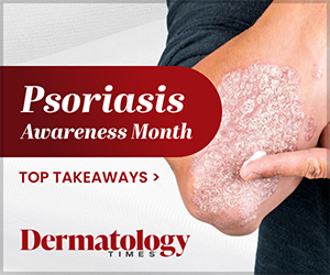 Highlights From Psoriasis Awareness Month