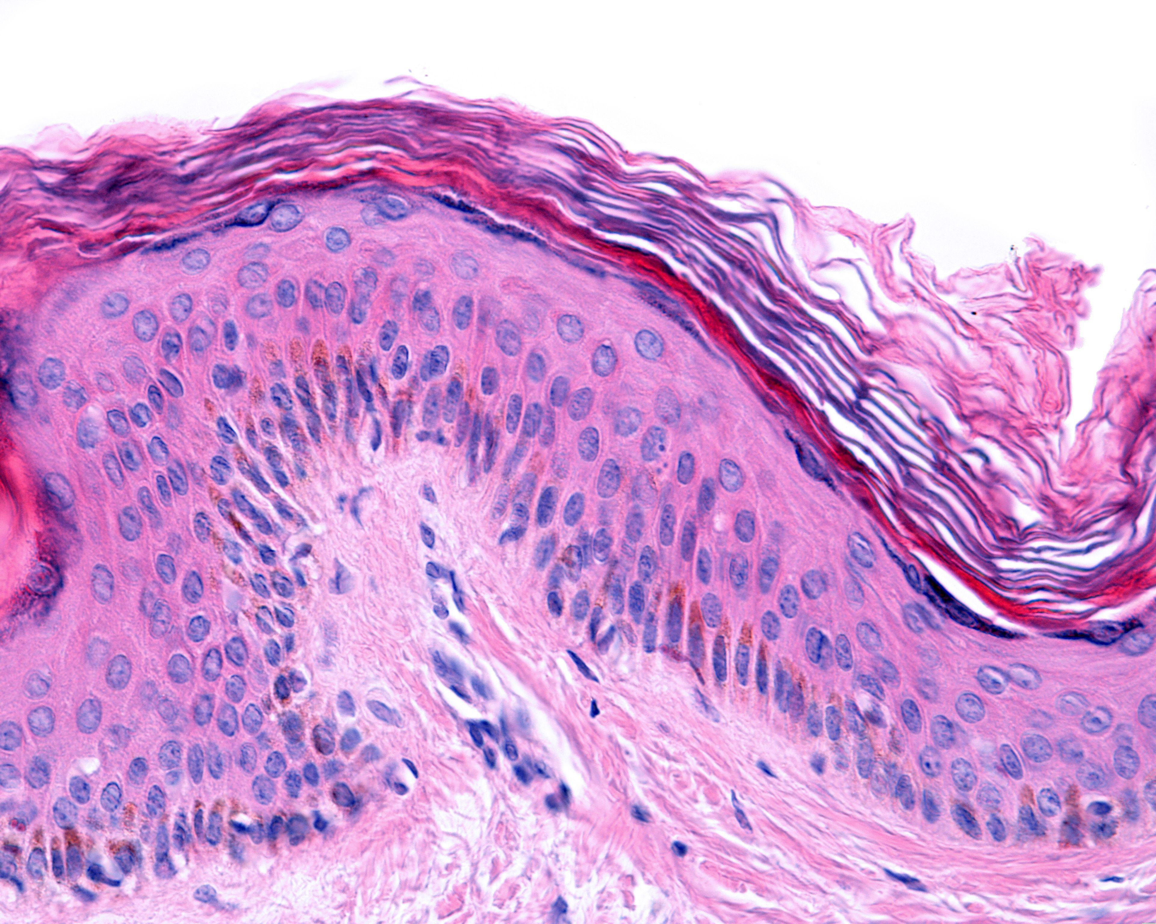 Taking a Comprehensive Approach to Common Vulvar Dermatoses