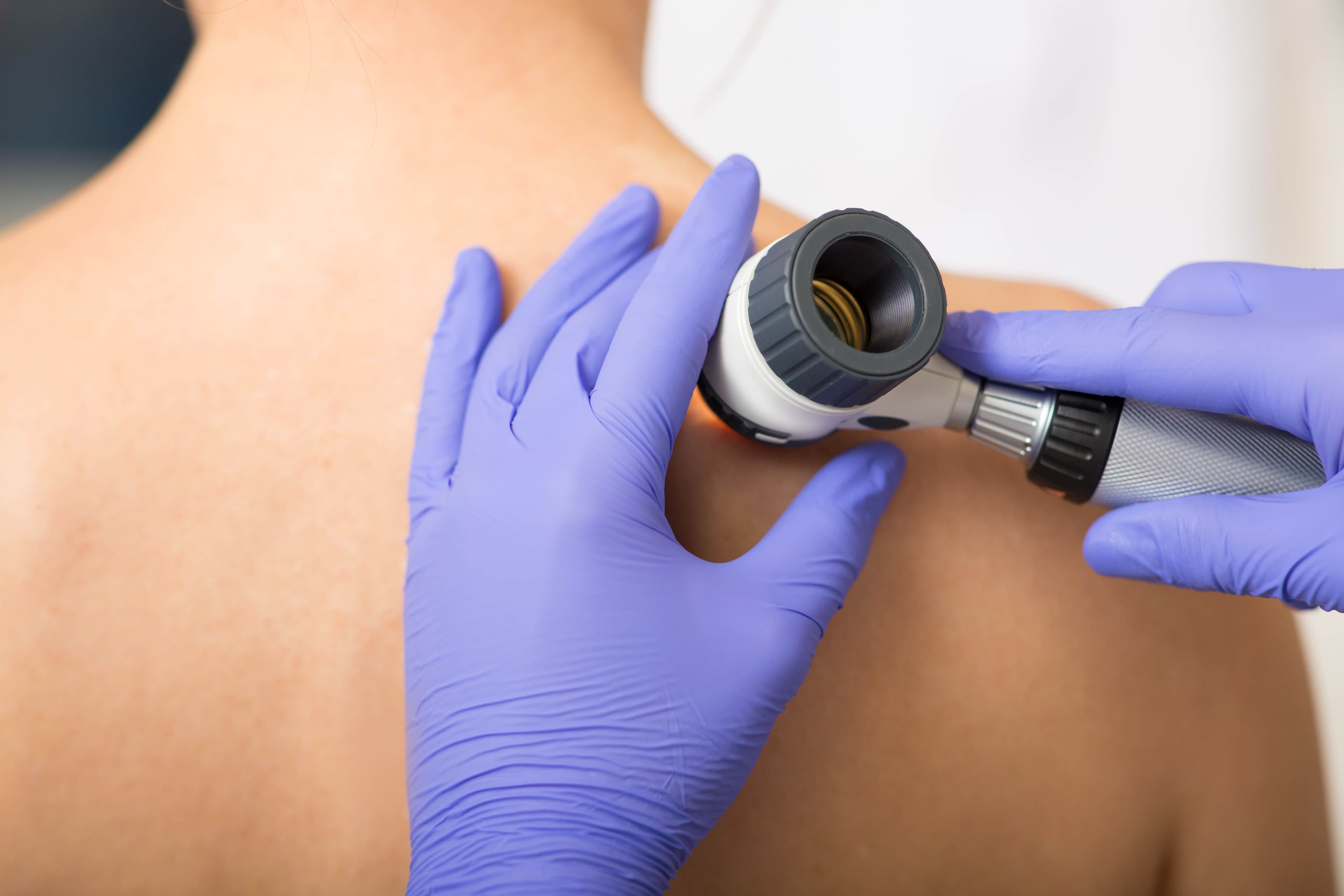 Dermatologist inspecting patient skin | Image Credit: © Peakstock - stock.adobe.com