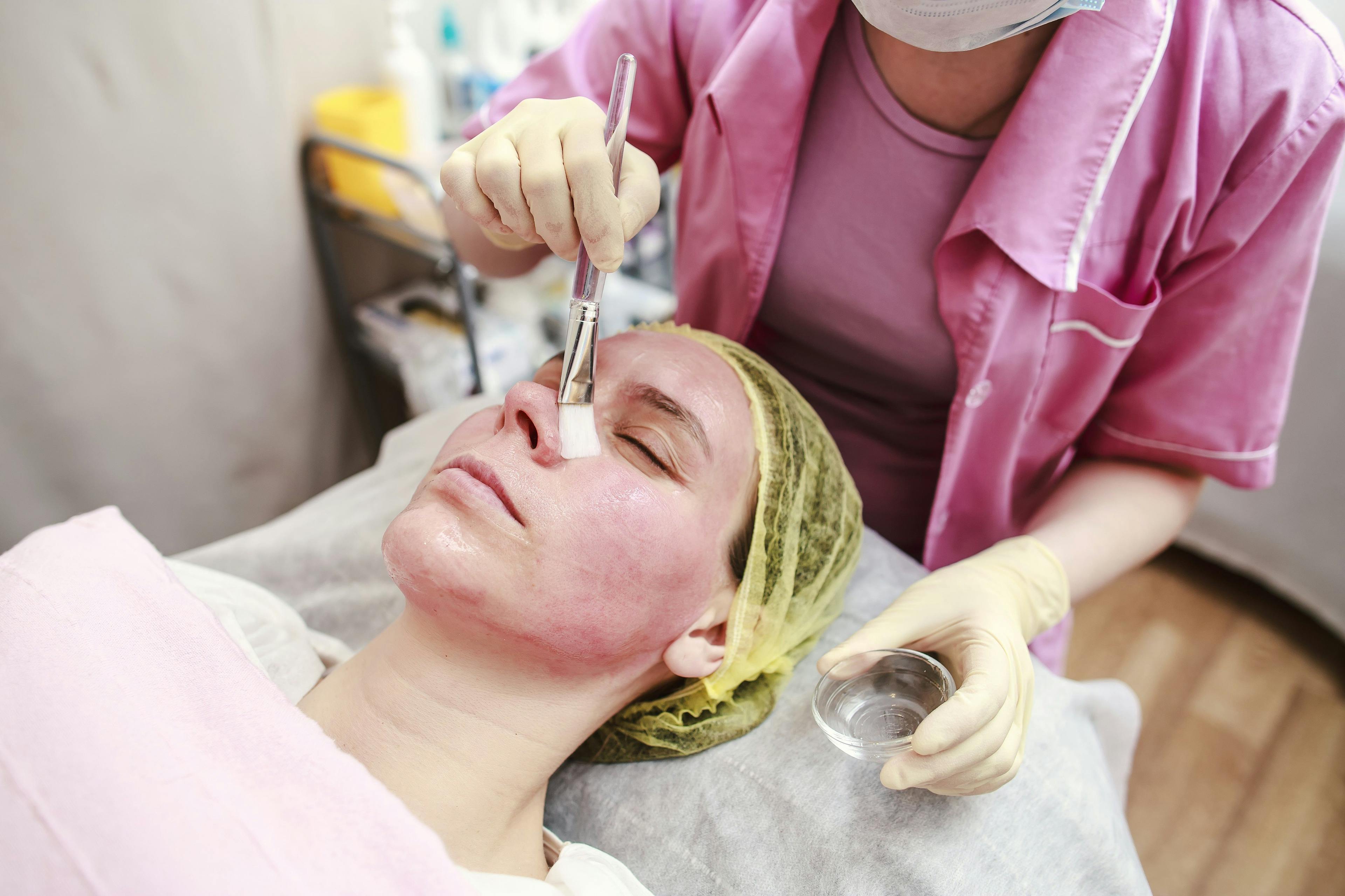 chemical peel procedure