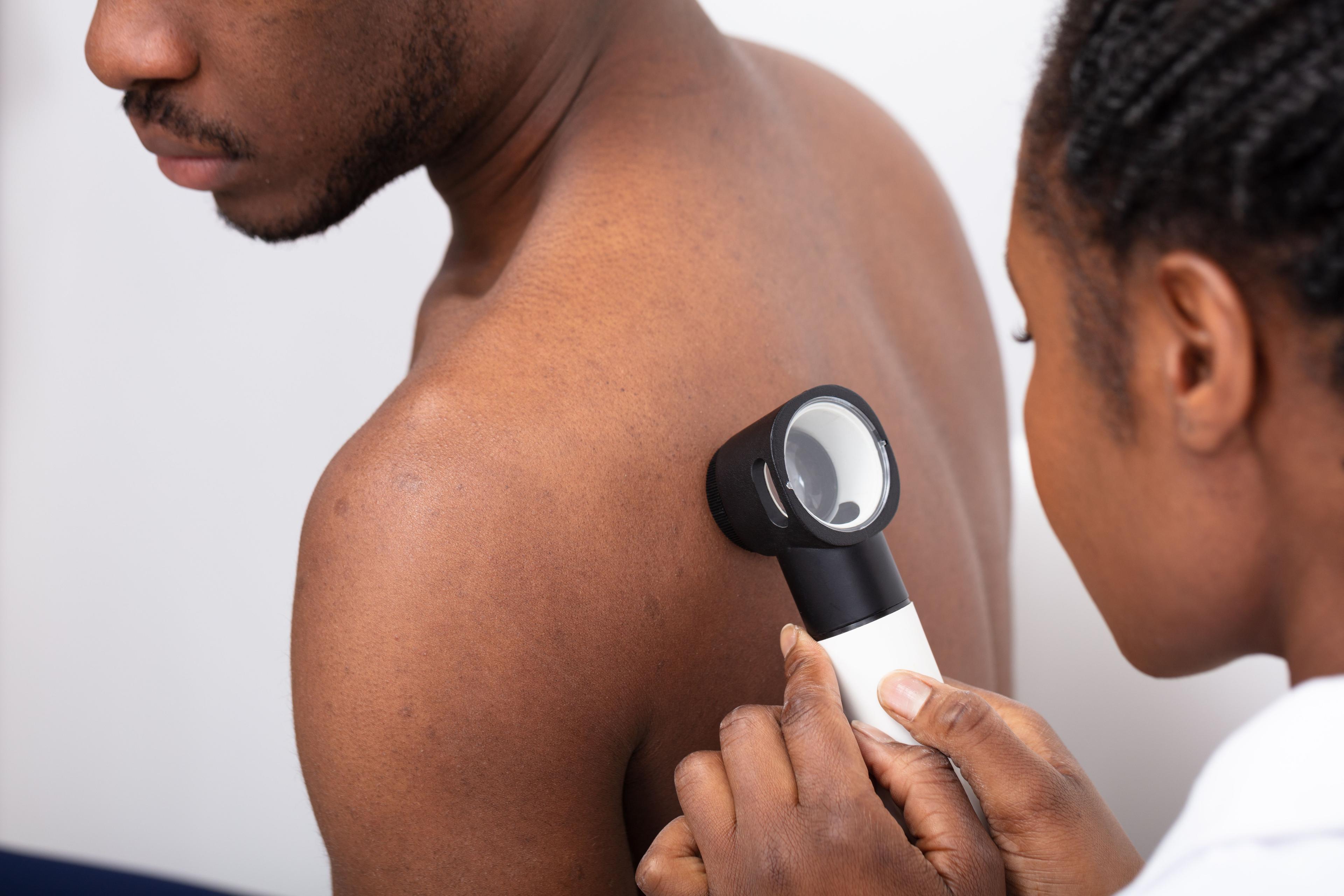 Doctor examining skin on patient's back