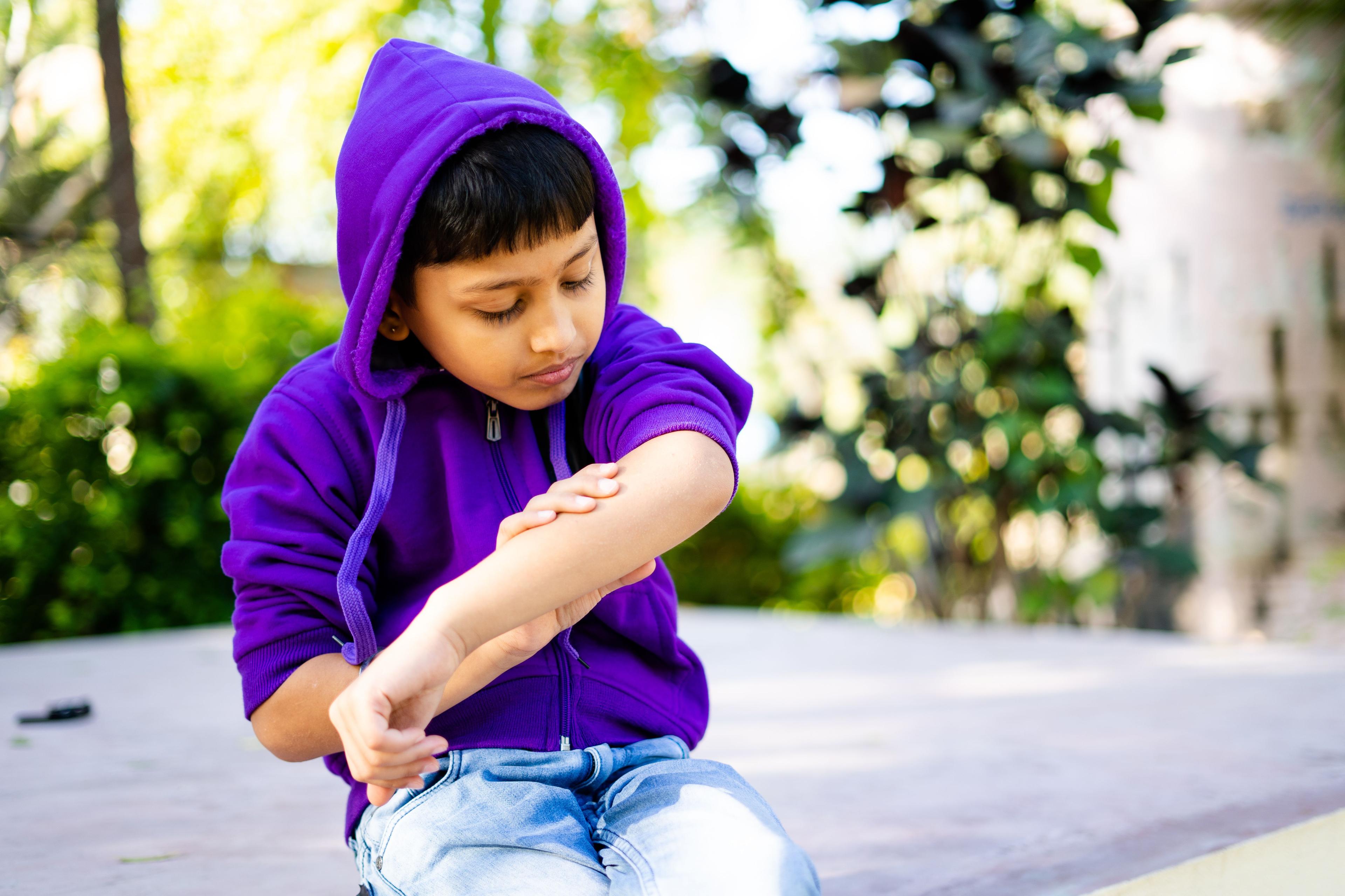 Young boy itching skin on arm