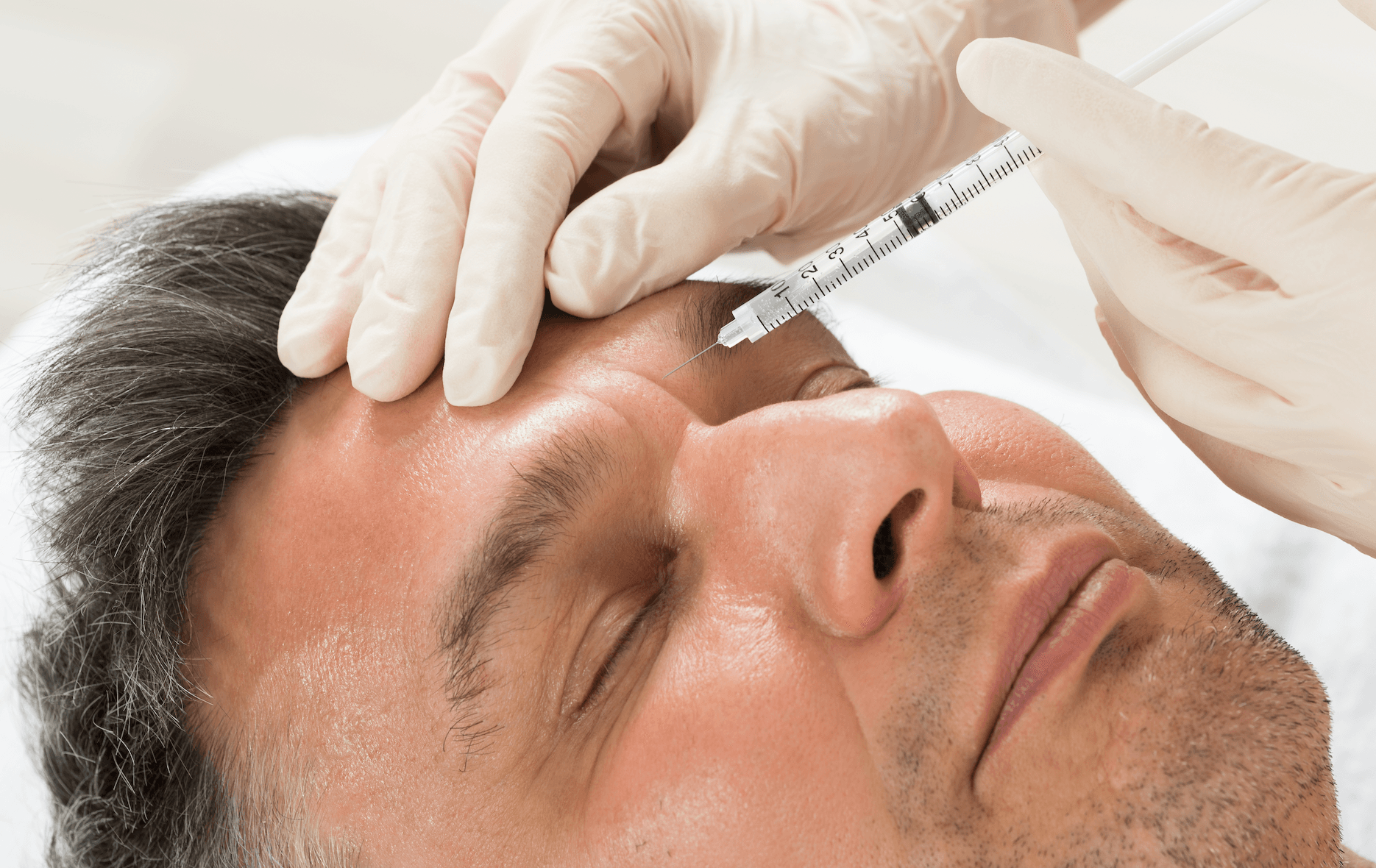 filler application in men