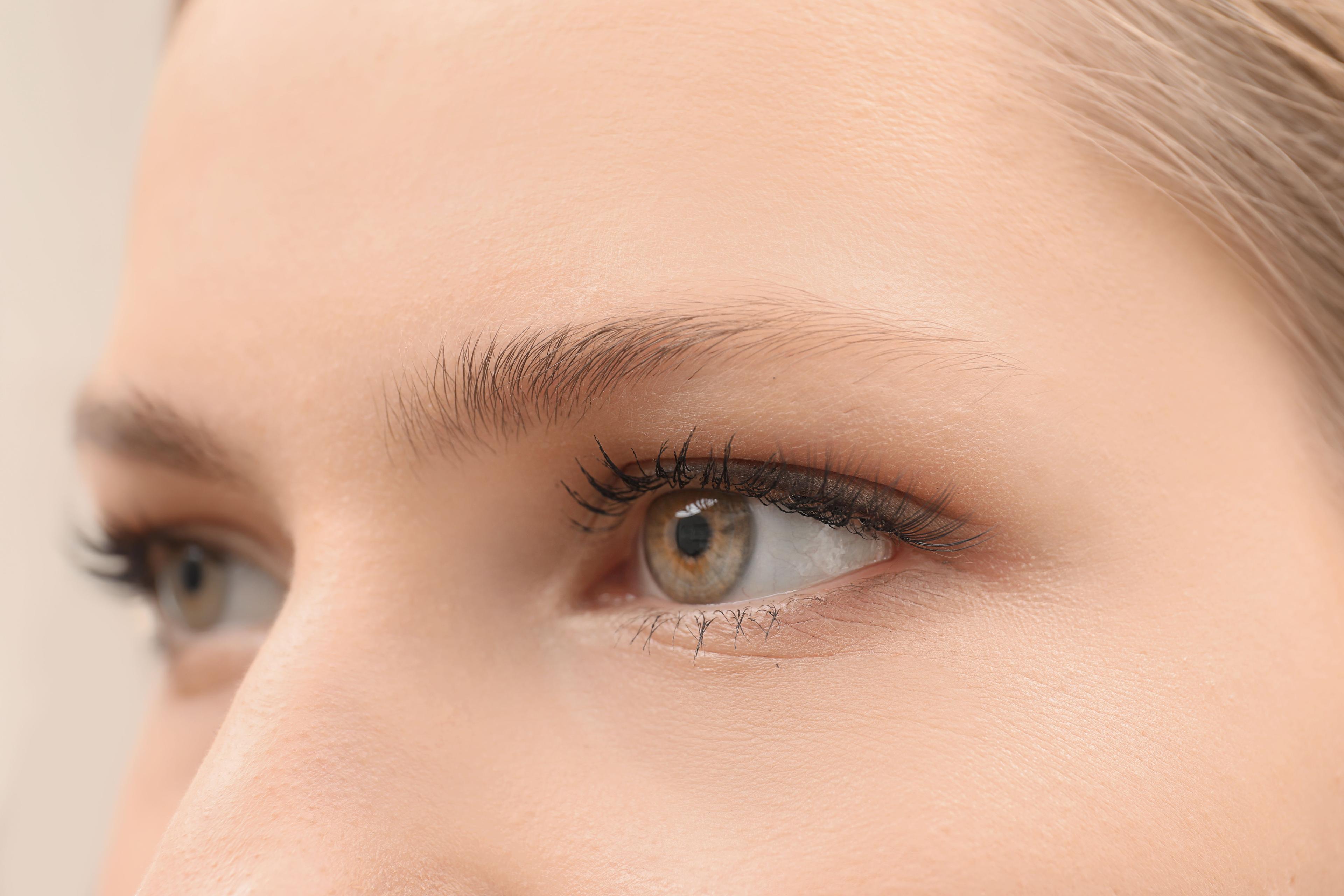 Understanding Eyebrow and Eyelash Hair Loss in Severe Alopecia Areata