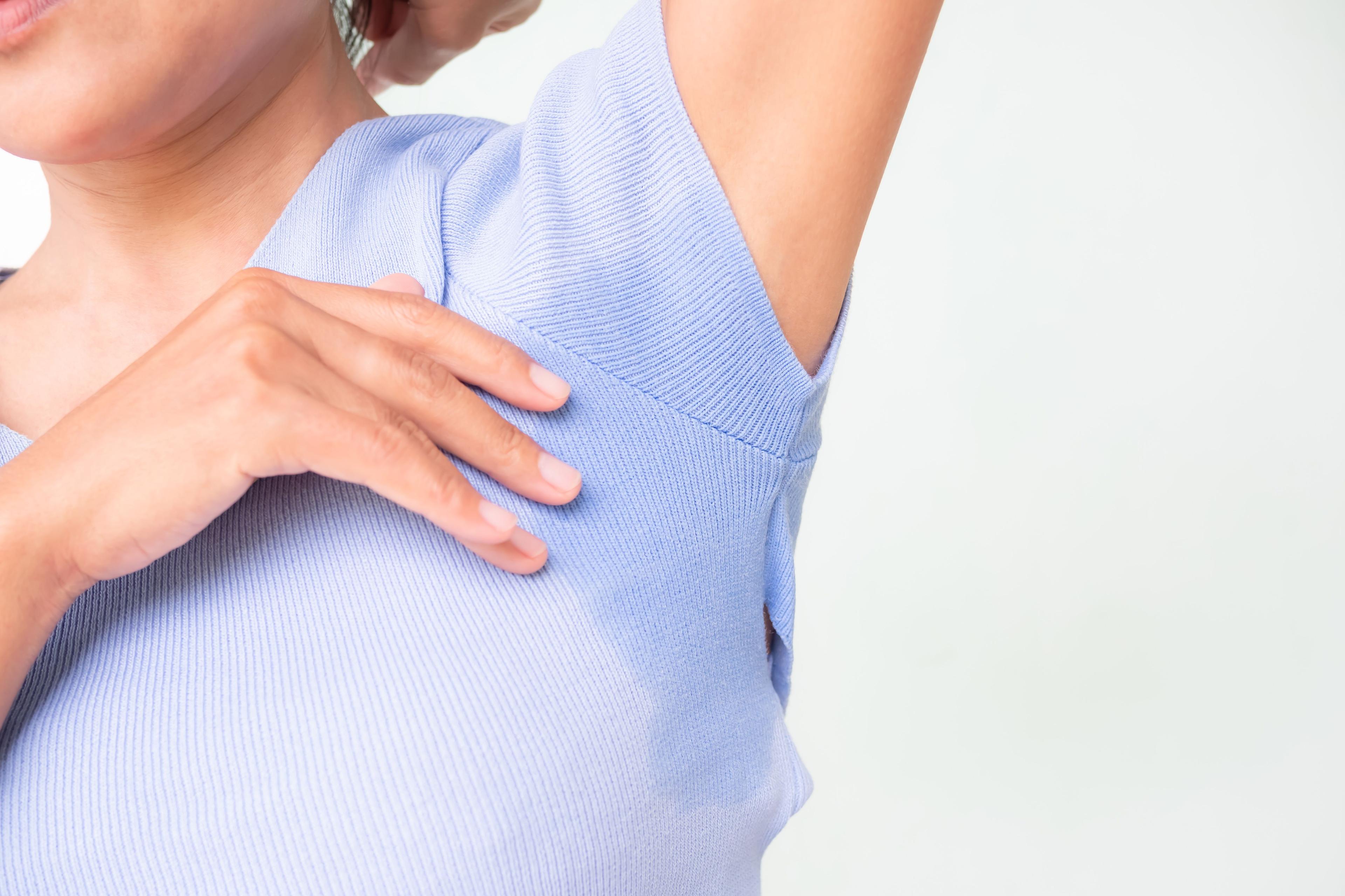 Young girl with axillary hyperhidrosis and sweating