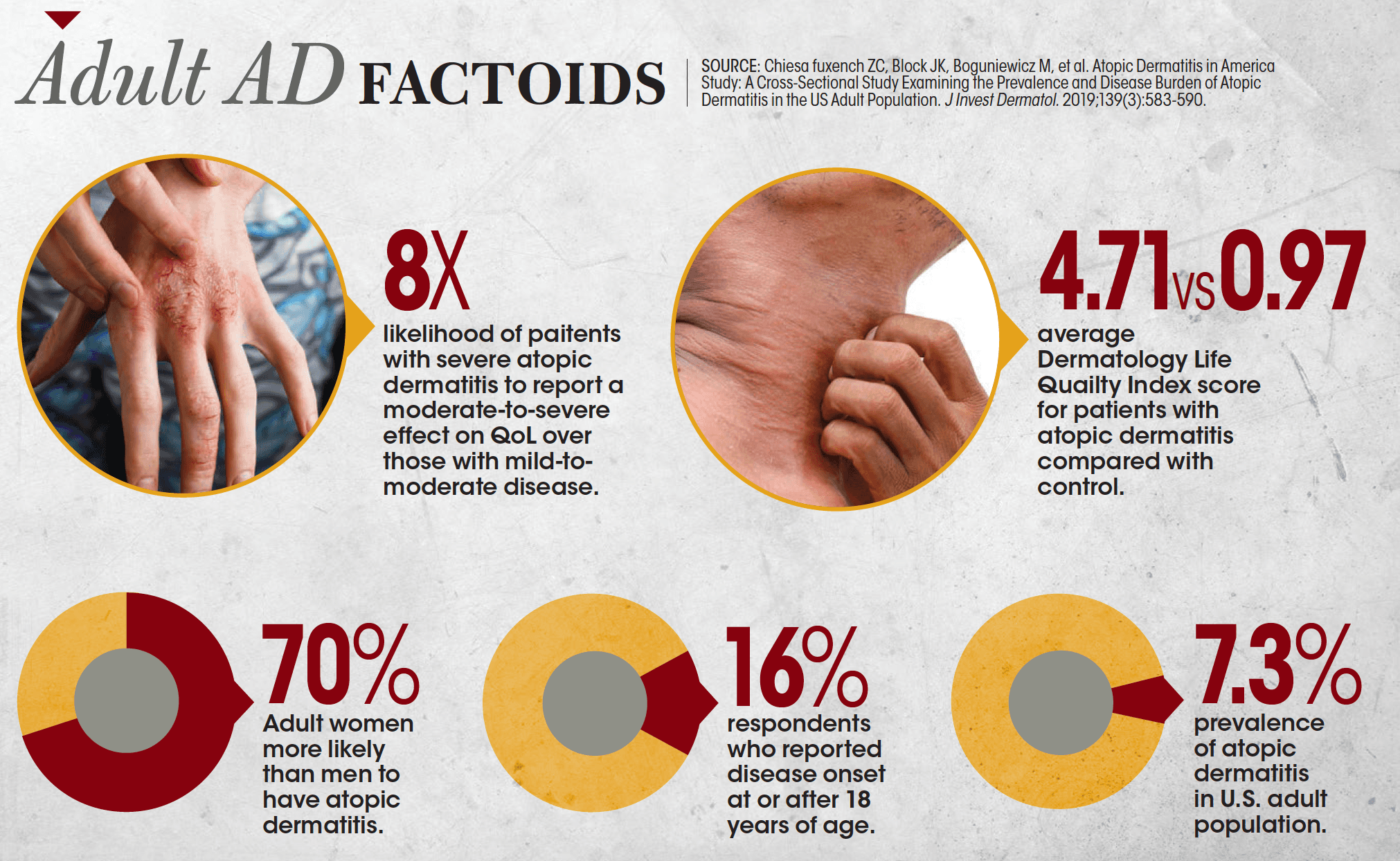 Adult atopic dermatitis data