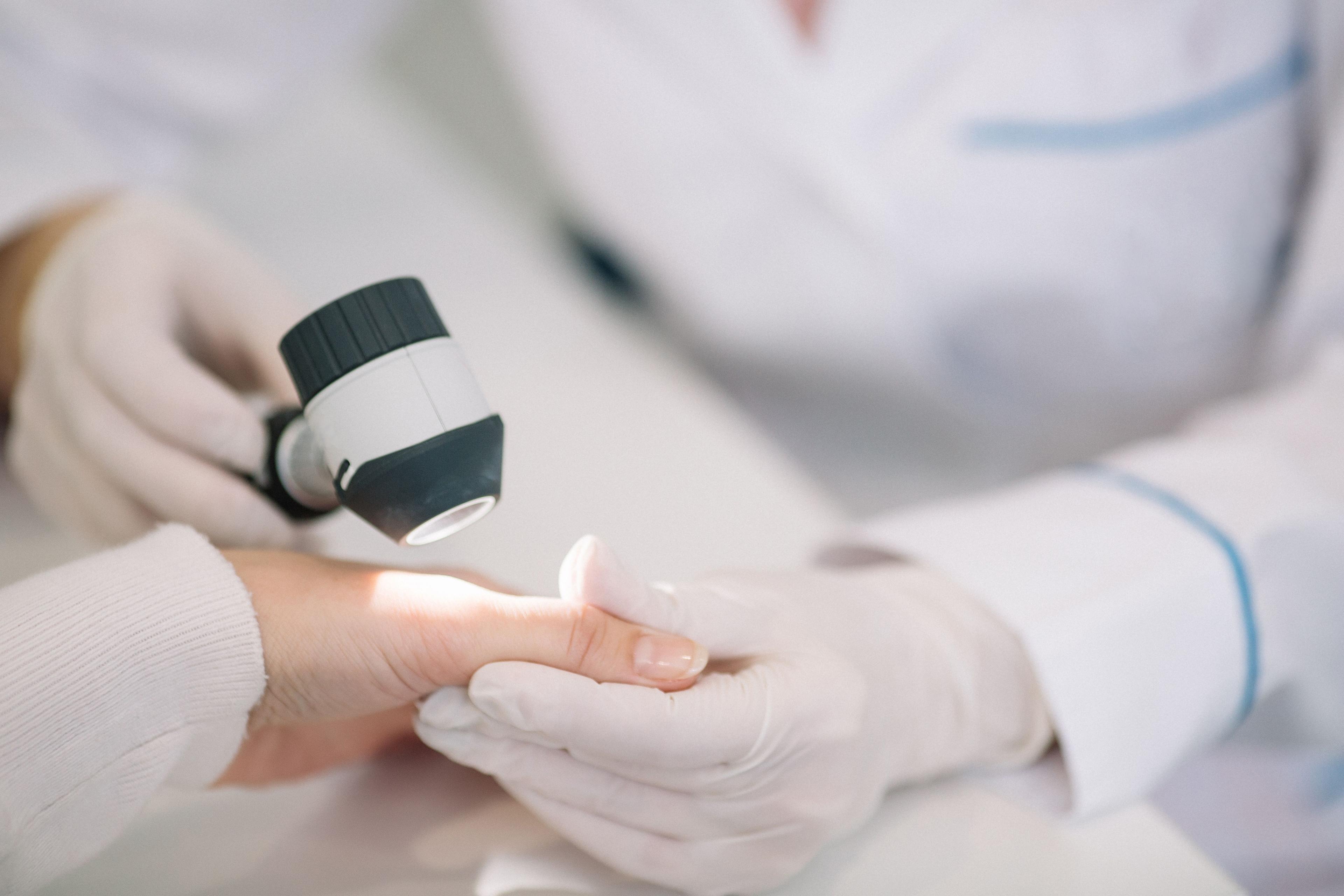 Dermatologist performing skin check on patient | Image Credit: © Evgene Kudryavtsev - stock.adobe.com