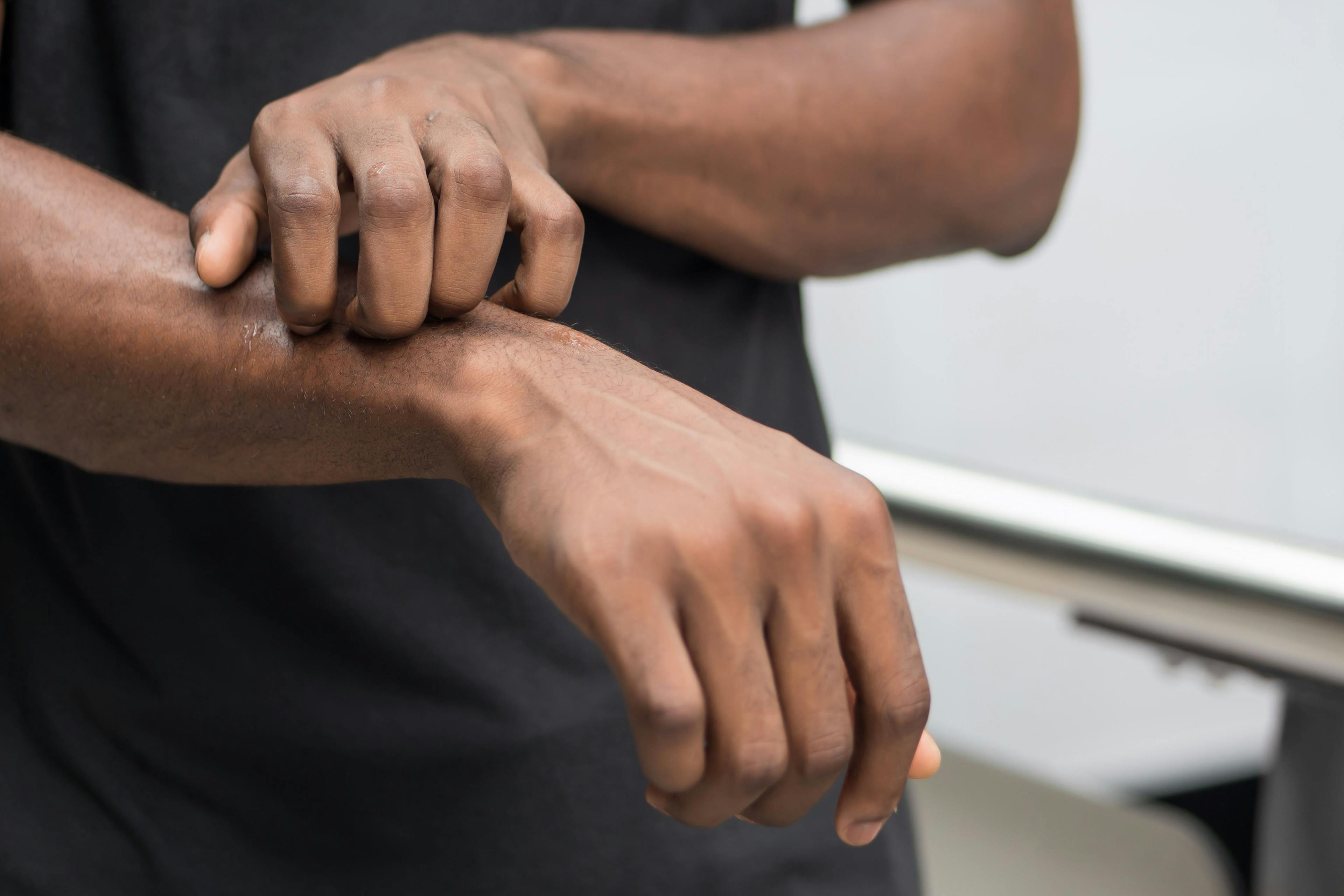 Close up of man scratching wrist
